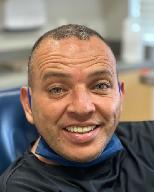 Patient smiling after treatment, photo 7
